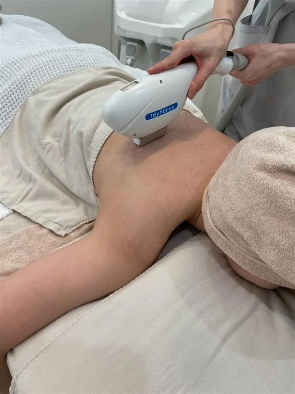 ベッドで横になった女性の腕に脱毛施術を行う様子